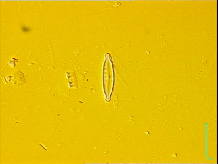 Cymbella microcephala, Grunow in Van Heurck, 1880 | Sandre 